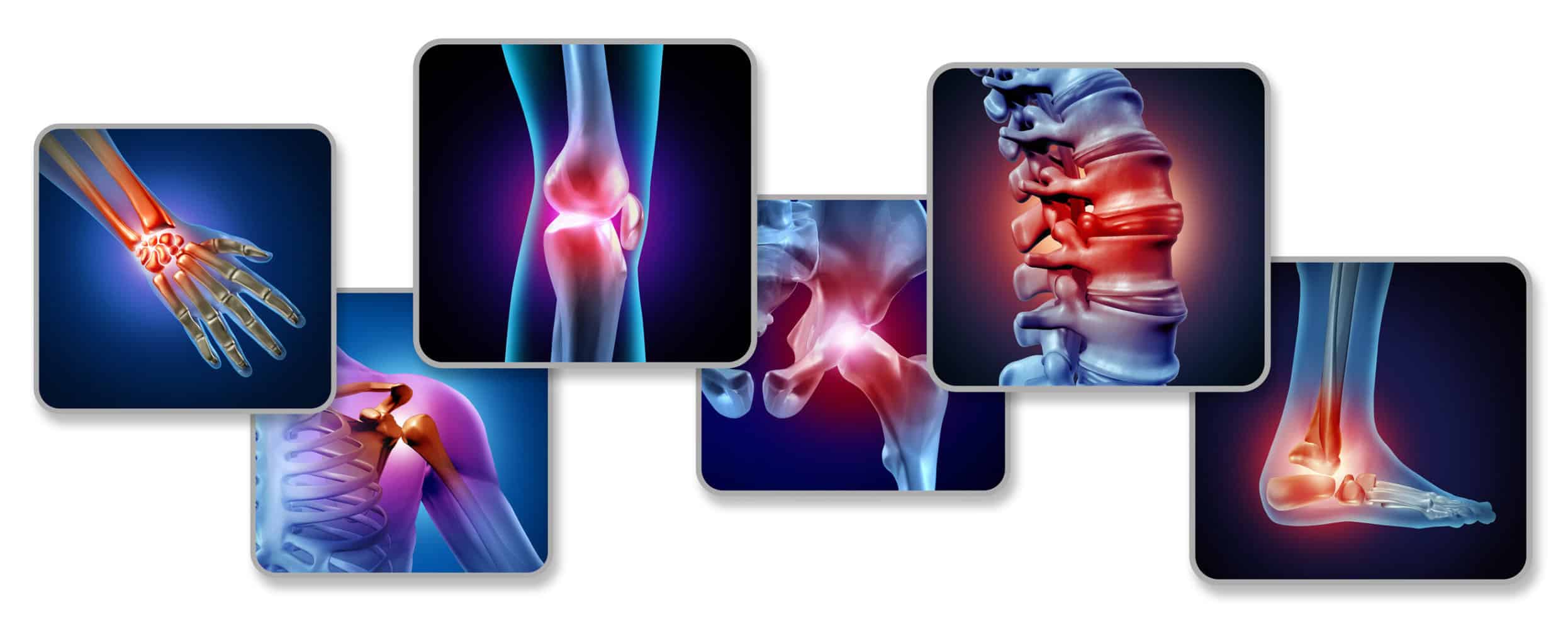 ain-of-the-joints-concept-as-skeleton-and-muscle-anatomy-of-the-body-with-a-group-of-sore-joints-as-a-painful-injury-or-arthritis-illness-symbol-for-health-care-and-medical-symptoms-with-3d-illustrati