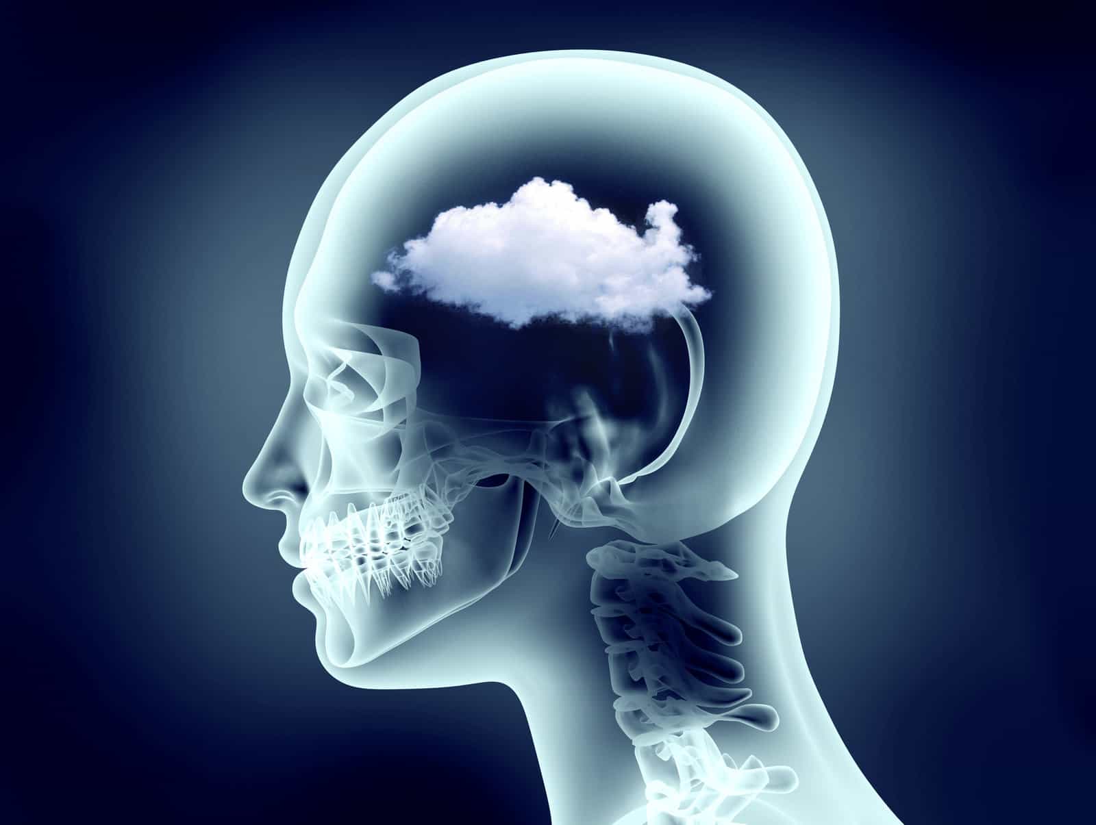 x-ray-image-of-human-head-with-cloud