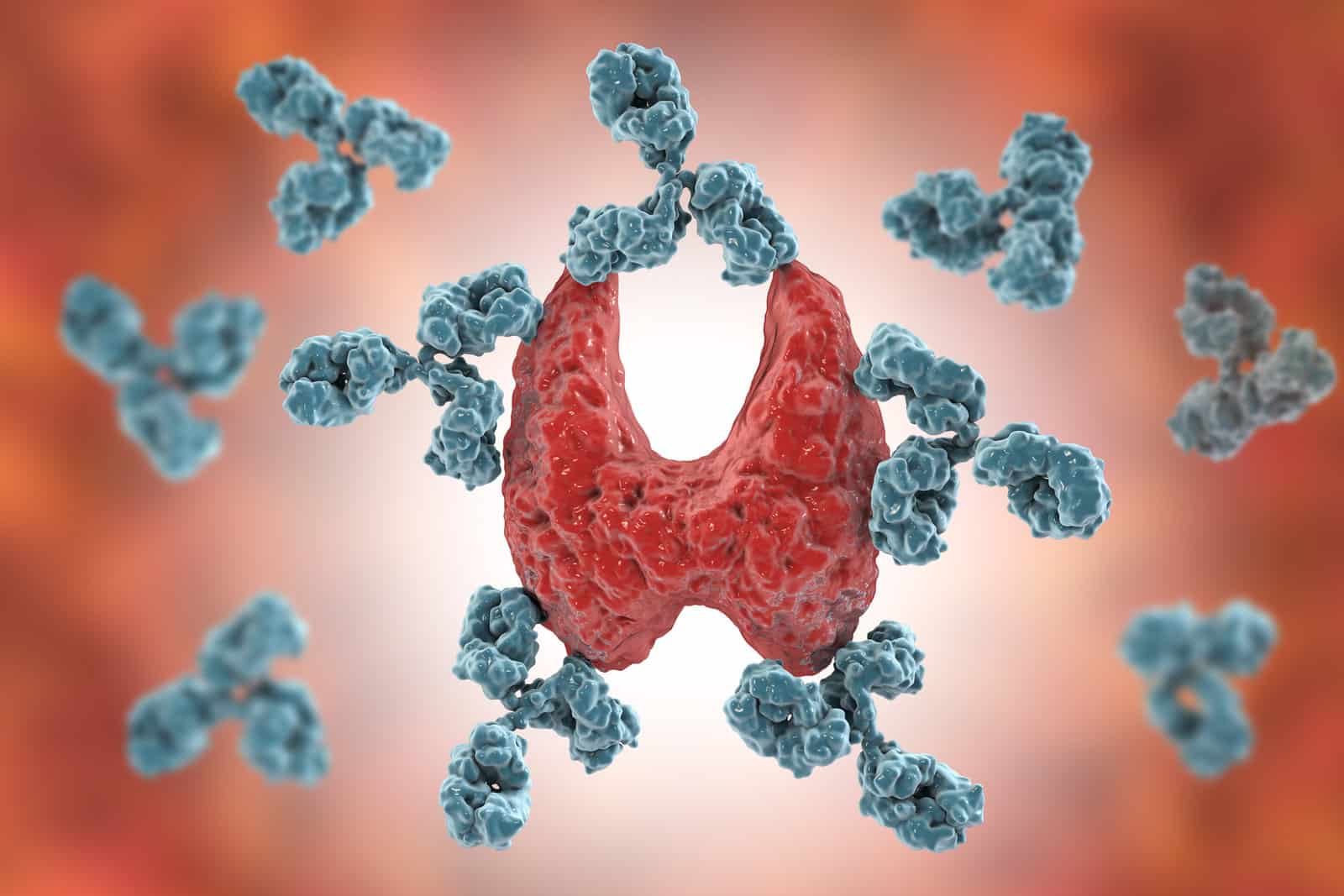 autoimmune-thyroiditis-hashimotos-disease-3d-illustration-showing-antibodies-attacking-thyroid-gland