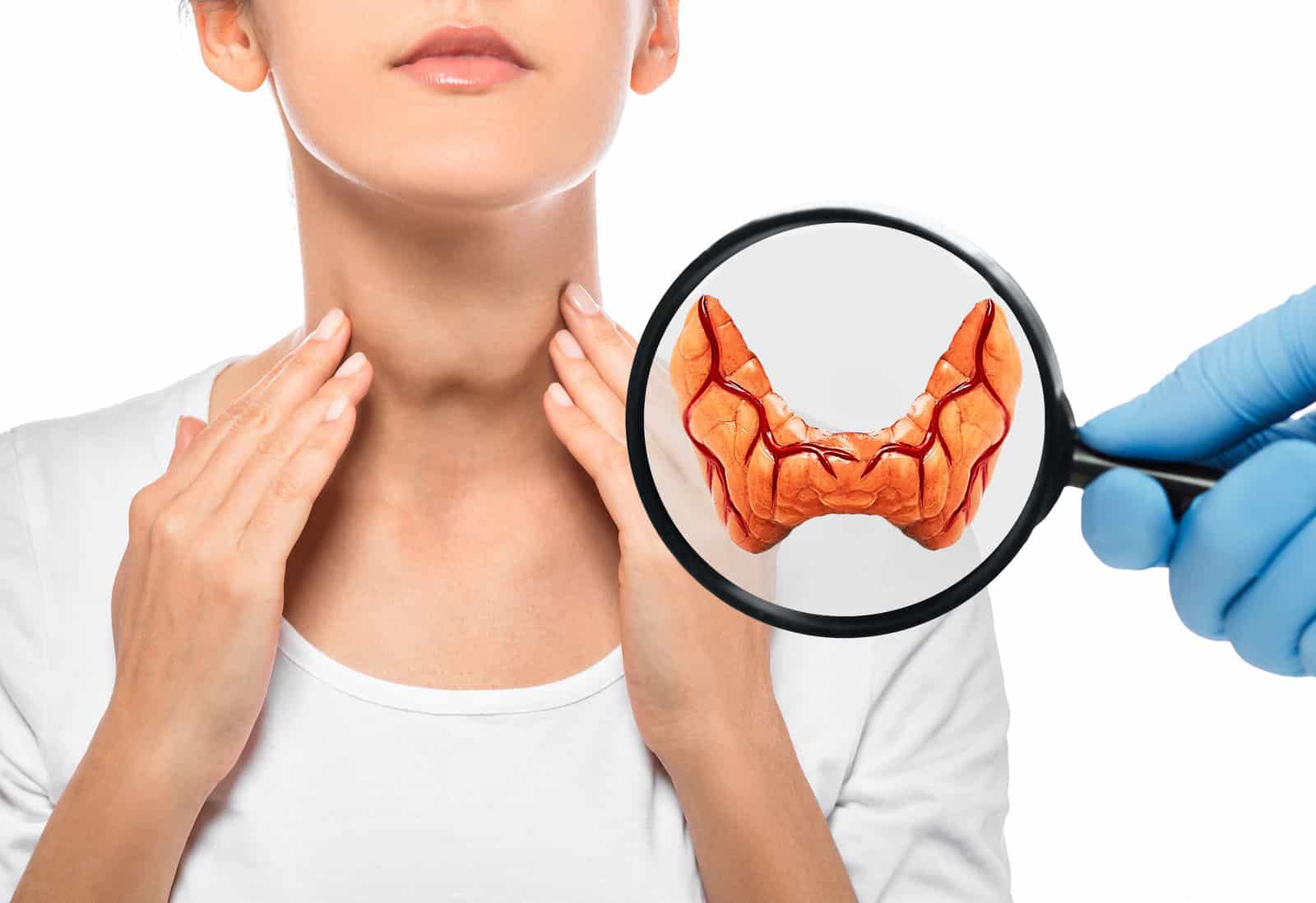 diagnosis-and-treatment-of-thyroid-diseases-endocrinology-anatomical-model-of-the-thyroid-gland-over-a-female-patient-background-thyrotoxicosis-and-hypothyroidism