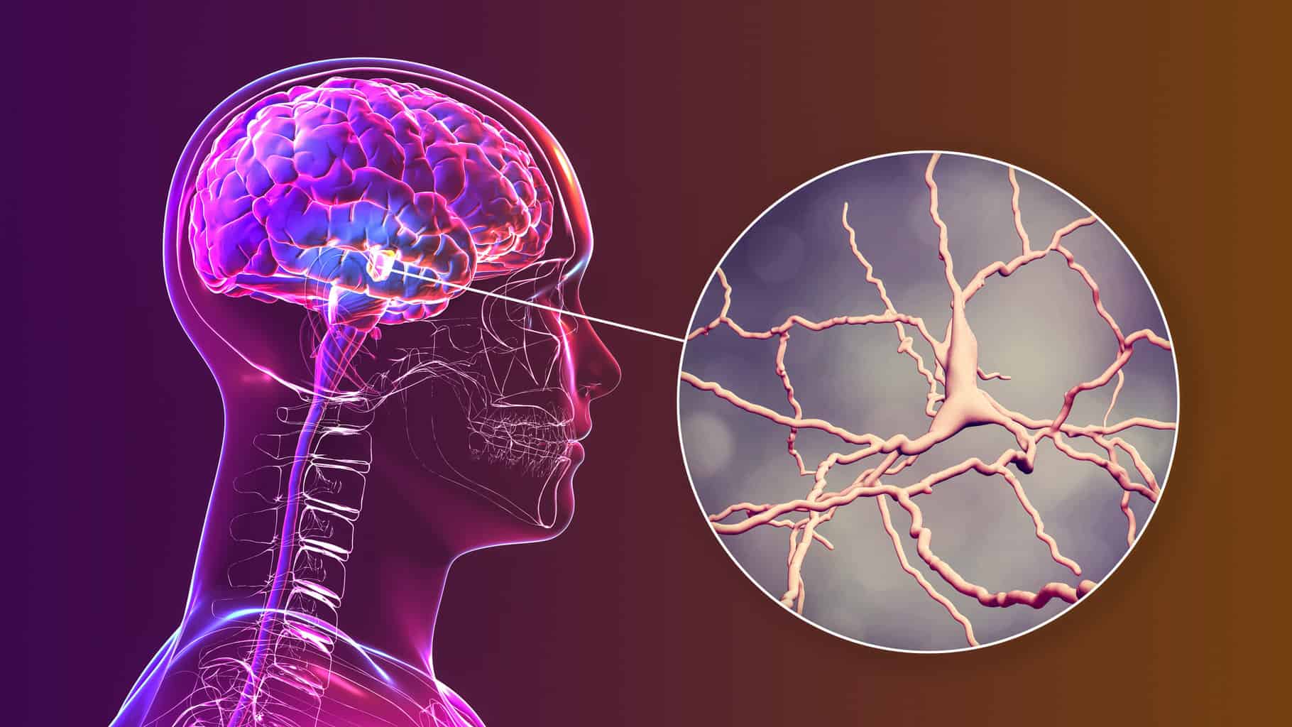 black-substance-of-the-midbrain-and-its-dopaminergic-neurons-3d-illustration-black-substance-regulates-movement-and-reward-its-degeneration-is-a-key-step-in-development-of-parkinsons-disease