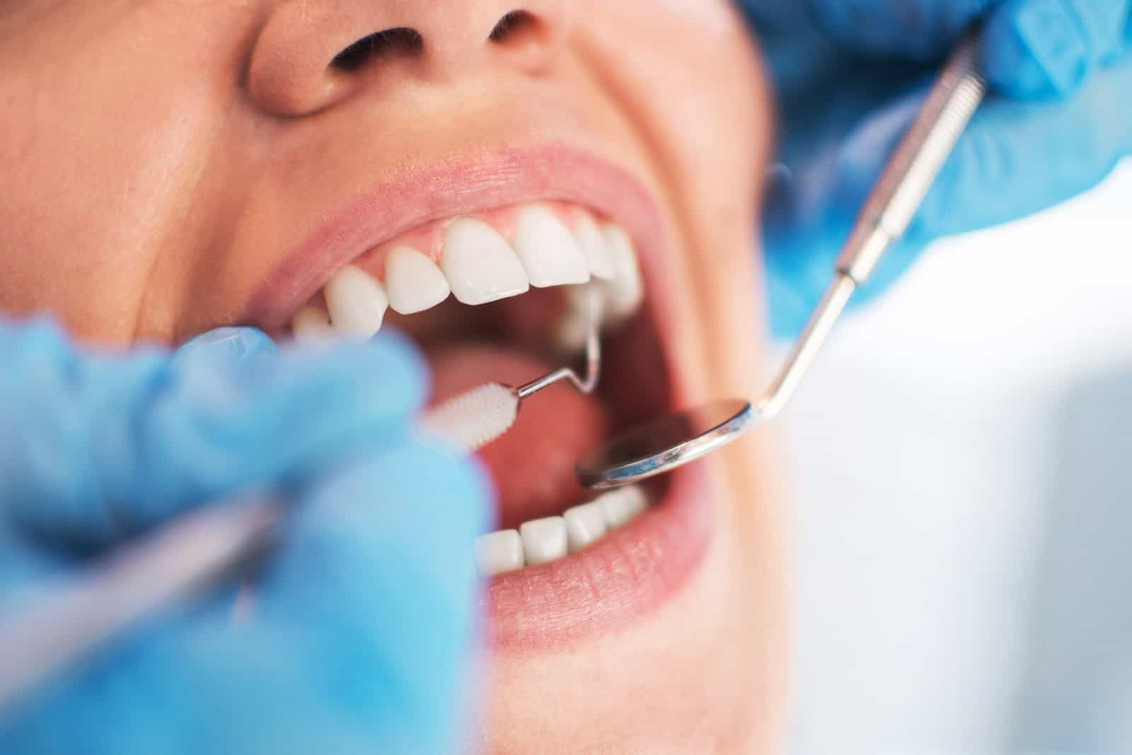 open-female-mouth-during-oral-checkup-at-the-dentist-selective-focus