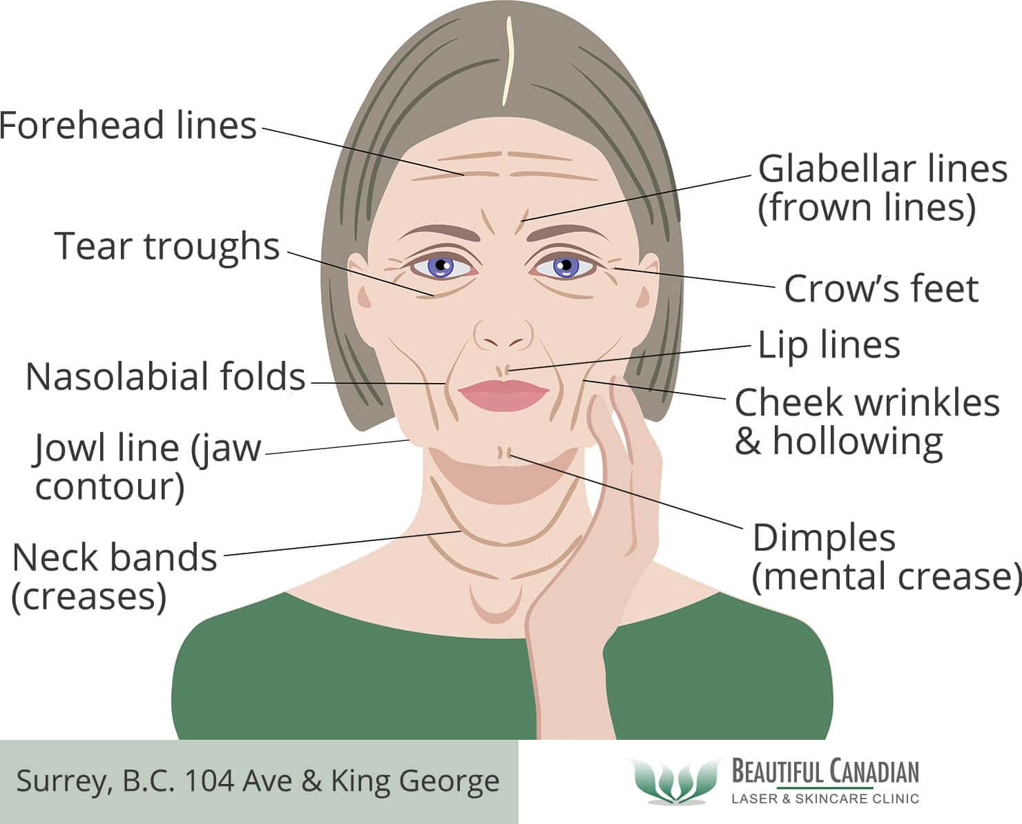 Wrinkle Wrinkles , How to Get Rid of Forehead Wrinkles, According to ...