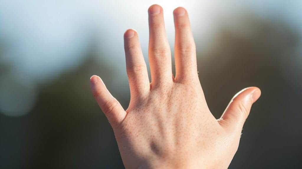 Recognize The Signs Of Skin Cancer Early Key Tips And Advice