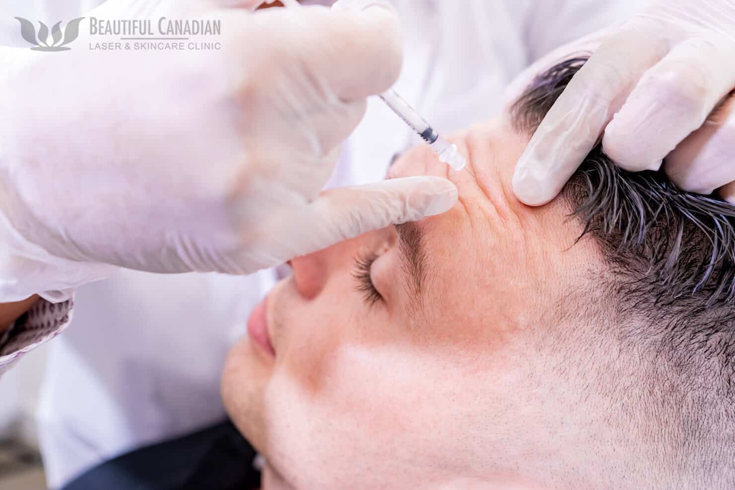 The “brotox” Trend Why Vancouver Botox® For Men Is Popular And What To Know Before Getting It