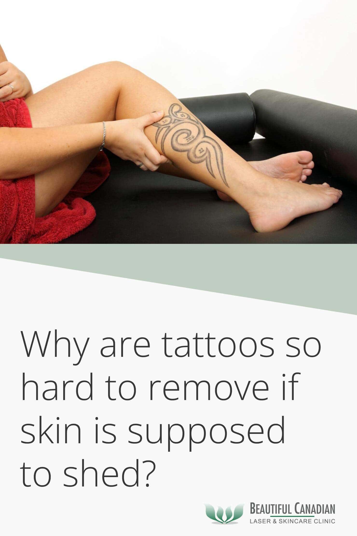 why-are-tattoos-so-hard-to-remove-if-skin-is-supposed-to-shed