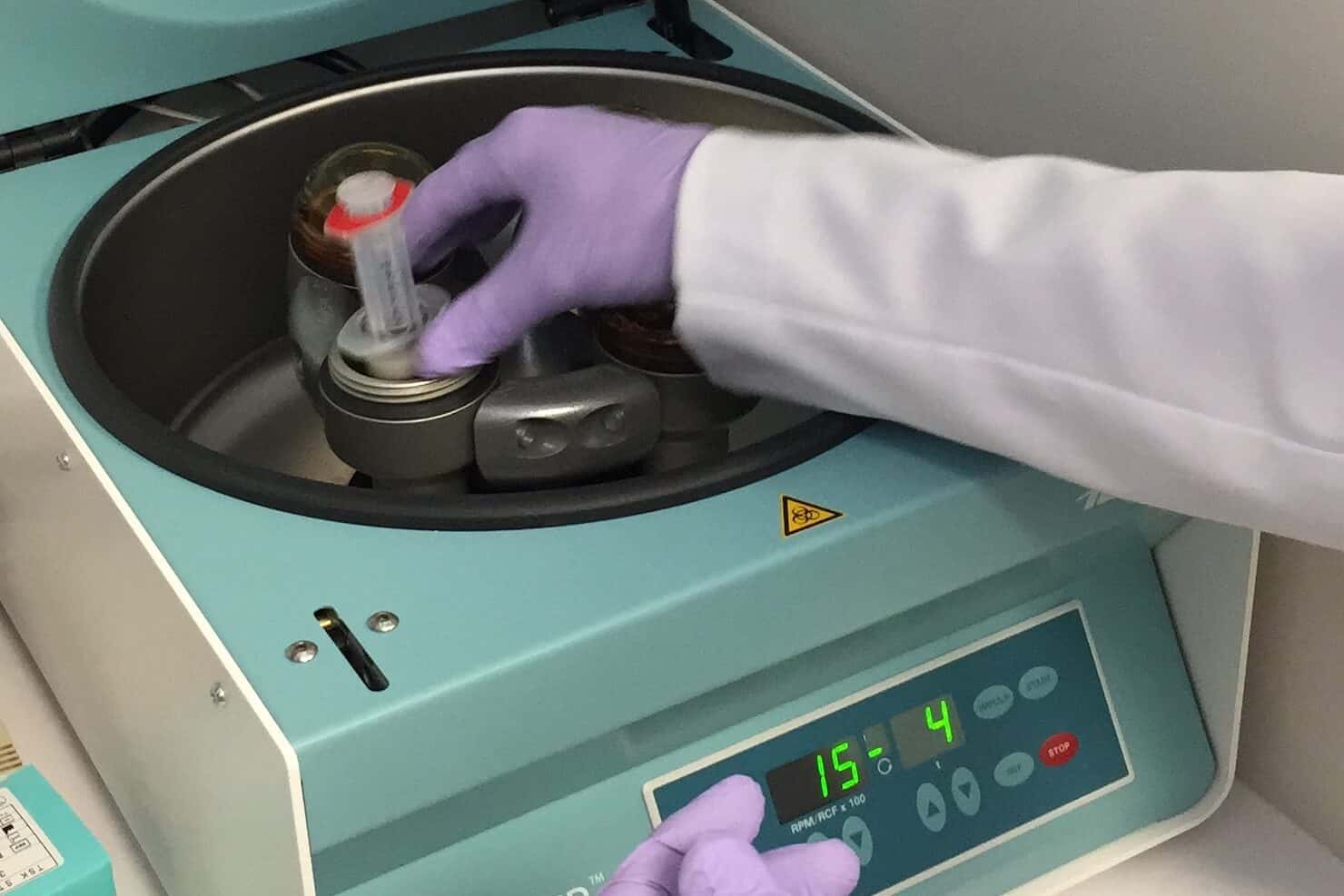 Doctor placing blood into centrifuge for PRP therapy treatment - available in Surrey