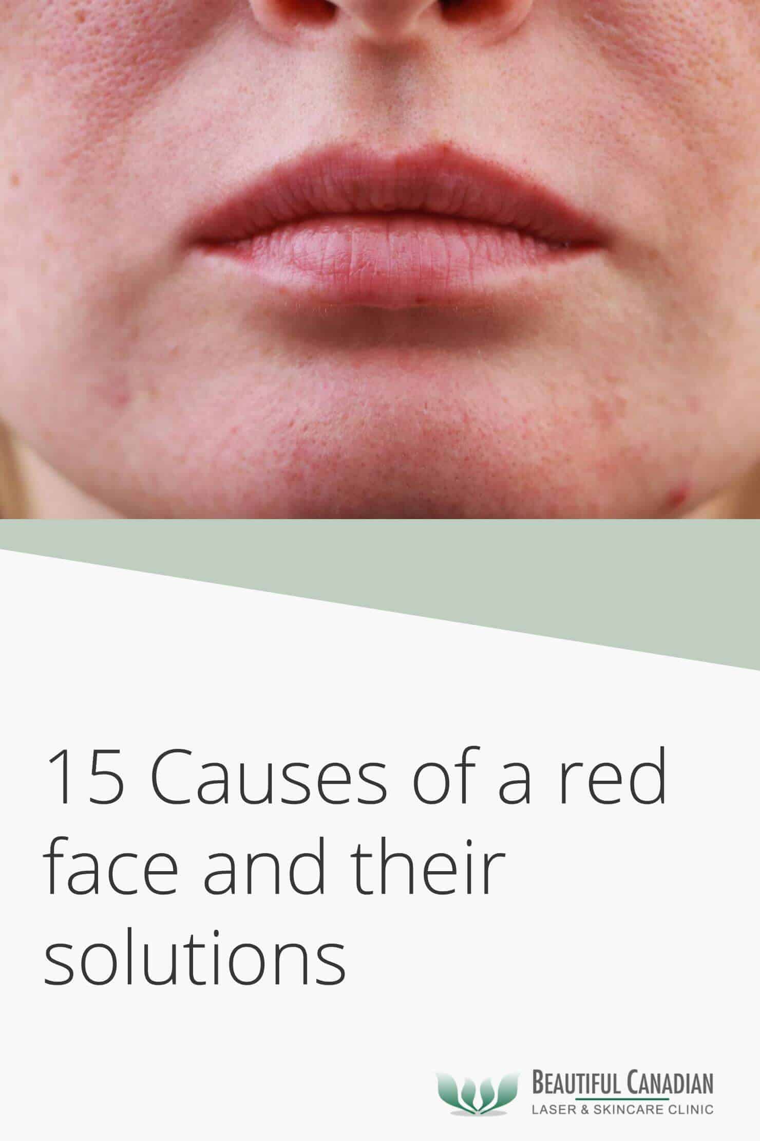 15 causes of a red face and their solutions - article pinterest image