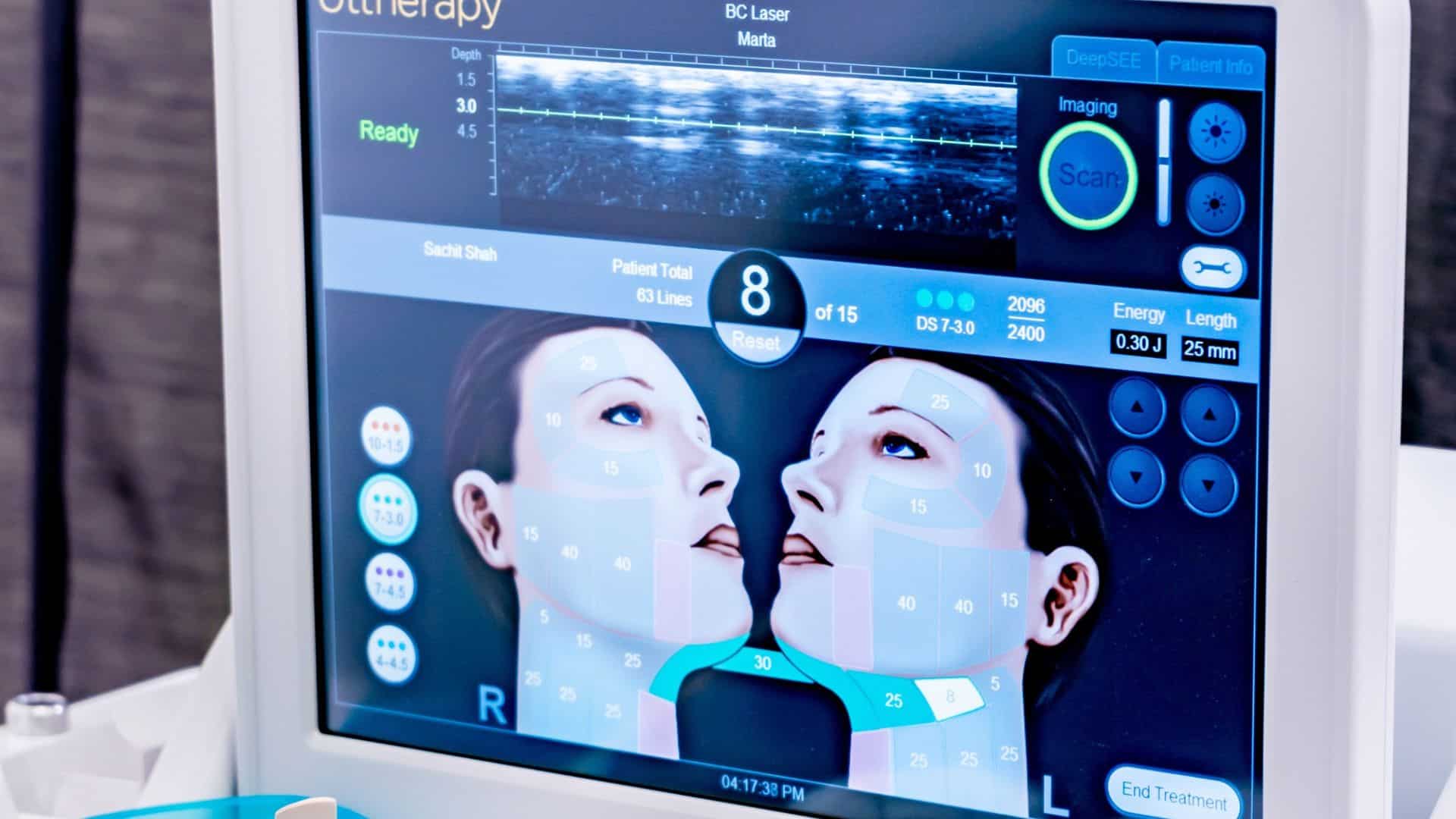 The Truth About Ultherapy: 5 Facts That Debunk Common Myths - Beautiful ...
