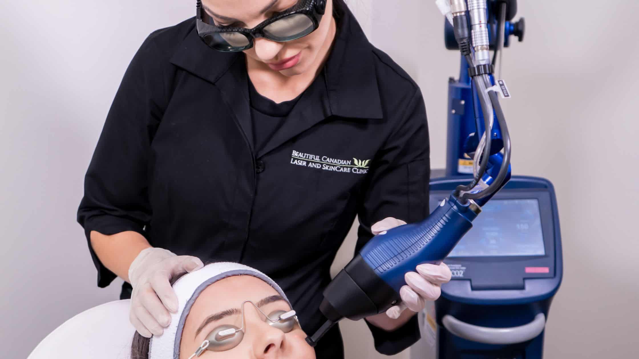 Fractional CO2 laser treatment at Beautiful Canadian Laser and Skincare Clinic in Surrey, BC