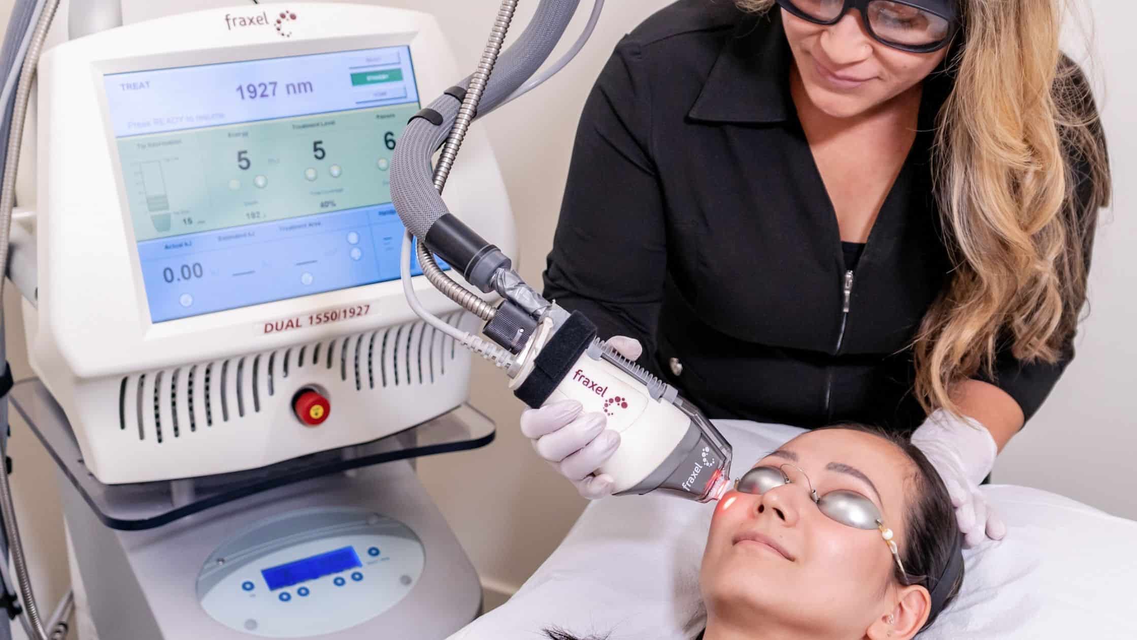 ThermaFrax laser treatment at Beautiful Canadian Laser and Skincare Clinic in Surrey, BC