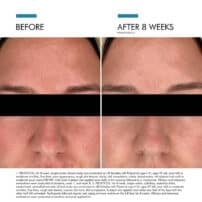 SkinCeuticals Clear Daily Soothing UV Defense SPF 50 - Image 6