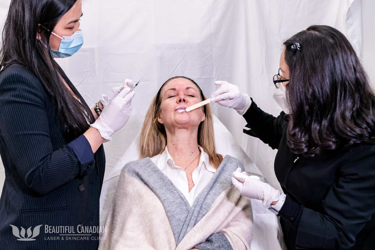 applying topical numbing cream for Vancouver lip filler treatment