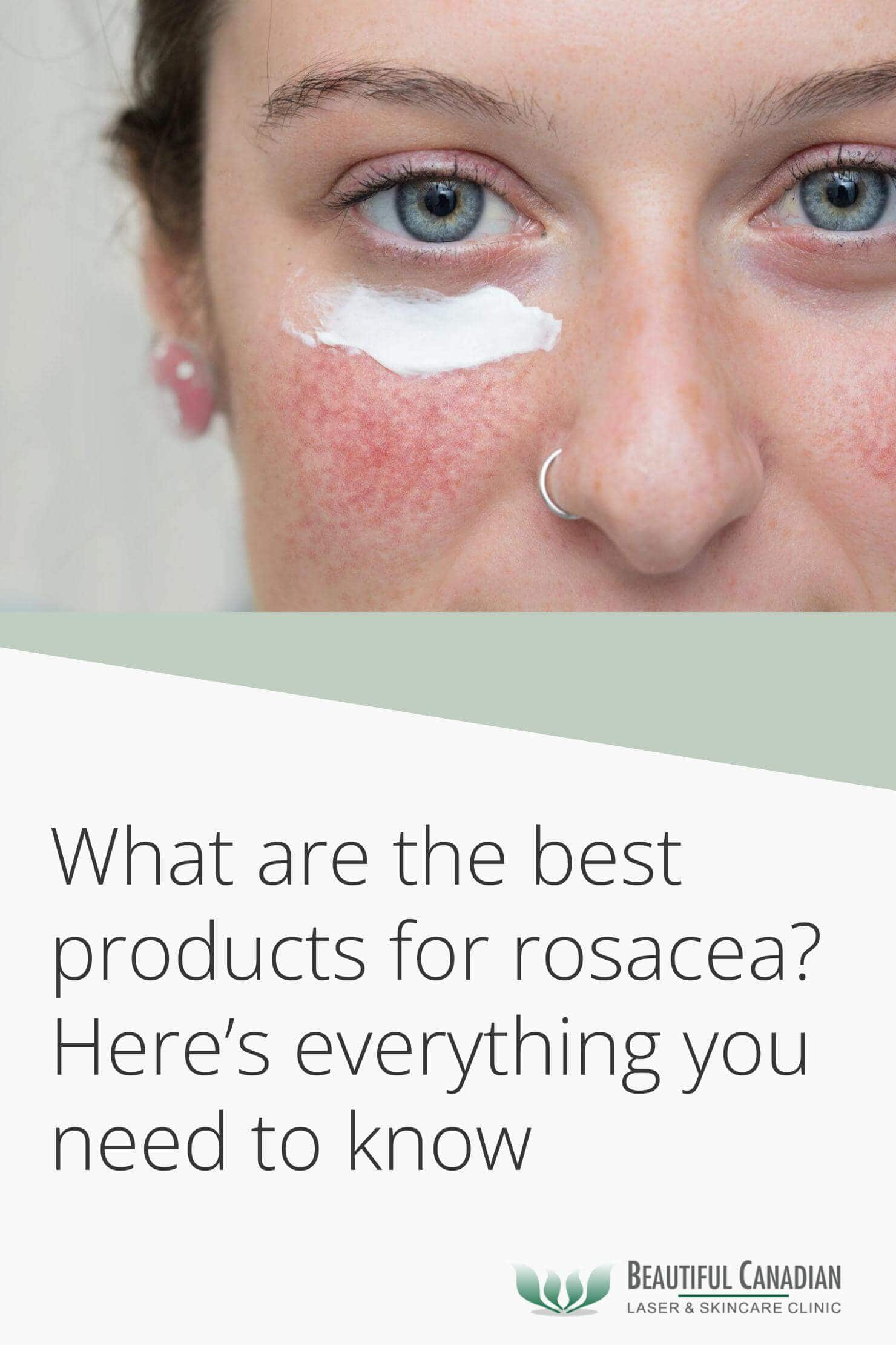 what are the best products for rosacea - everything to know - article pinterest image