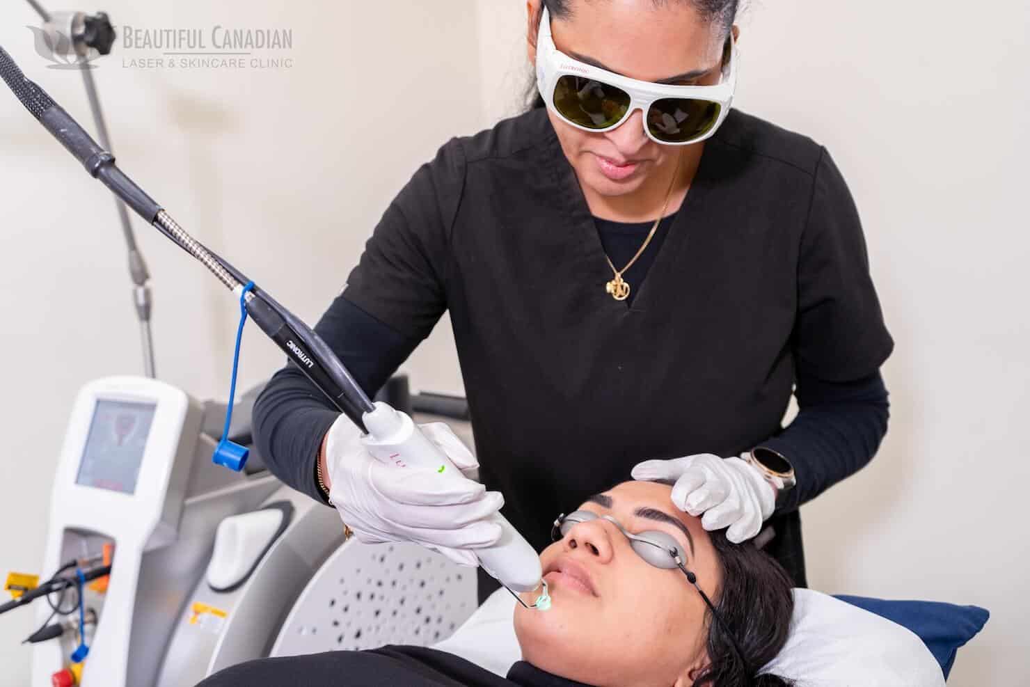 Full view Clarity laser acne treatment on chin in Vancouver Surrey