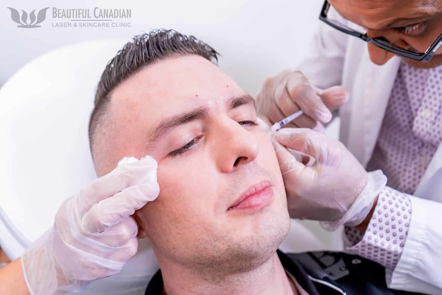 Doctor and assistant hands performing a Vancouver Botox treatment for eye wrinkles on a male patient