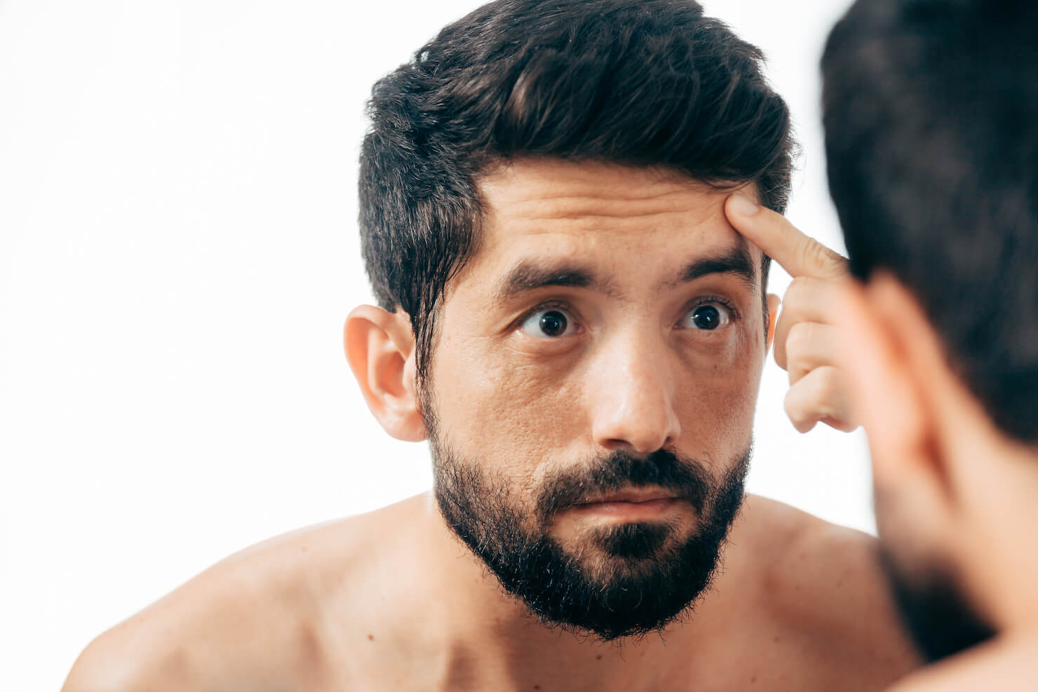 Male looking in mirror examining forehead wrinkles as a treatment condition