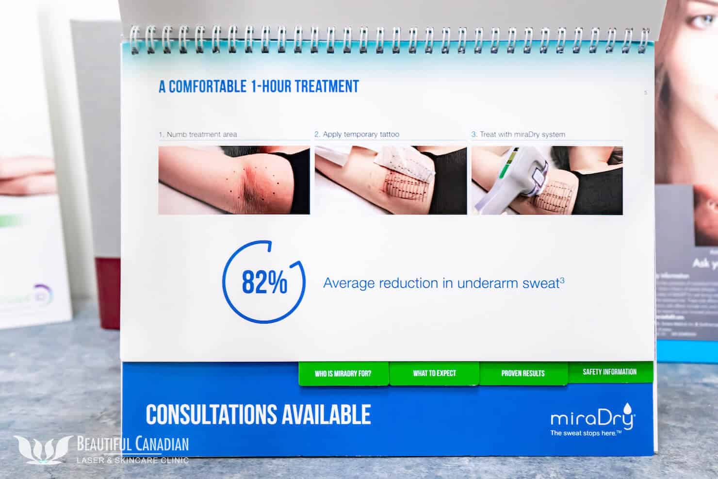 miradry treatment pamphlet showing templating process - available in surrey