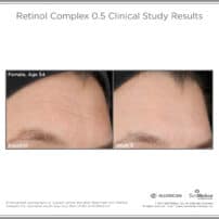 SkinMedica Before and After photo of Retinol Complex .5 - high end skincare results from clinical study