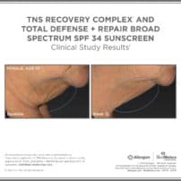 SkinMedica Before and After photo of TNS Recovery Complex with Total Defense and Repair SPF 34 - high end skincare results