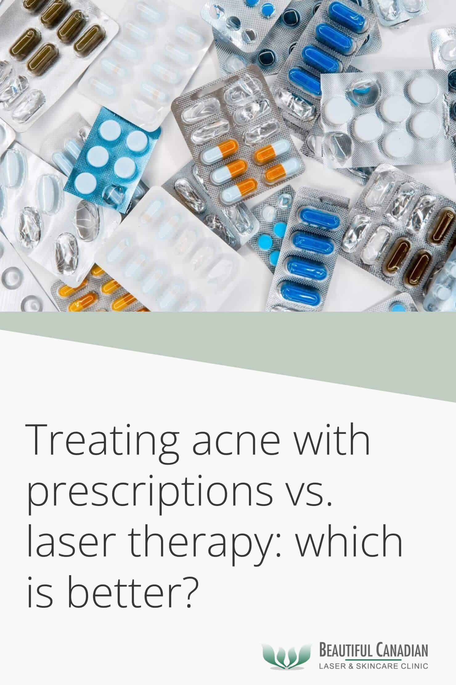 Treating acne with prescriptions vs lasers - which is better - Pinterest image