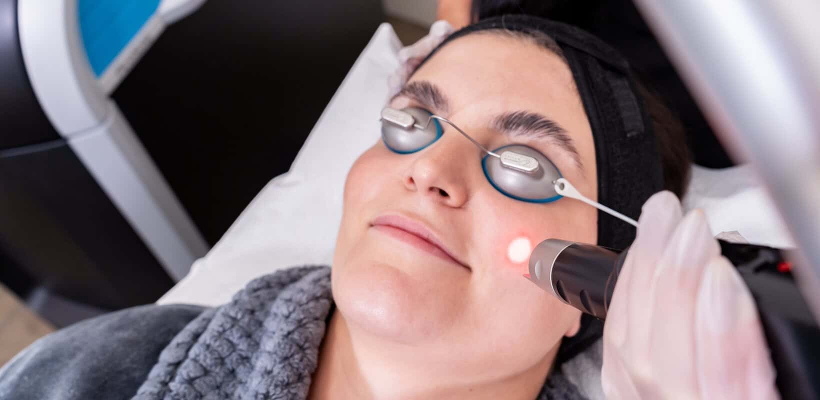 Surrey picosure laser facial patient for hyperpigmentation removal