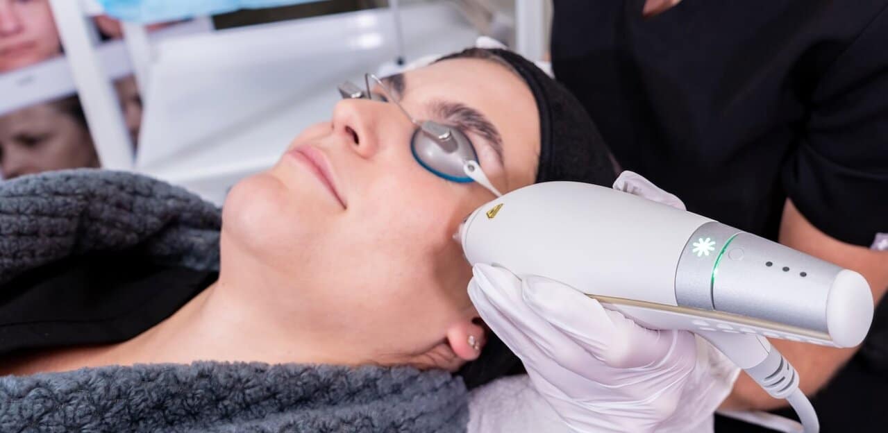 Vancouver Clear and Brilliant treatment in Surrey with 1440nm handpiece - side view