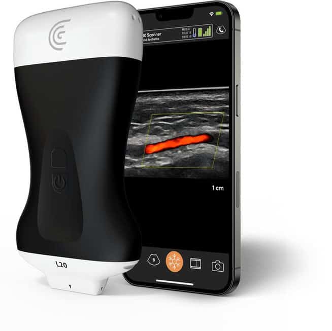 Clarius ultrasound device with phone imaging scan and app - isolated on white