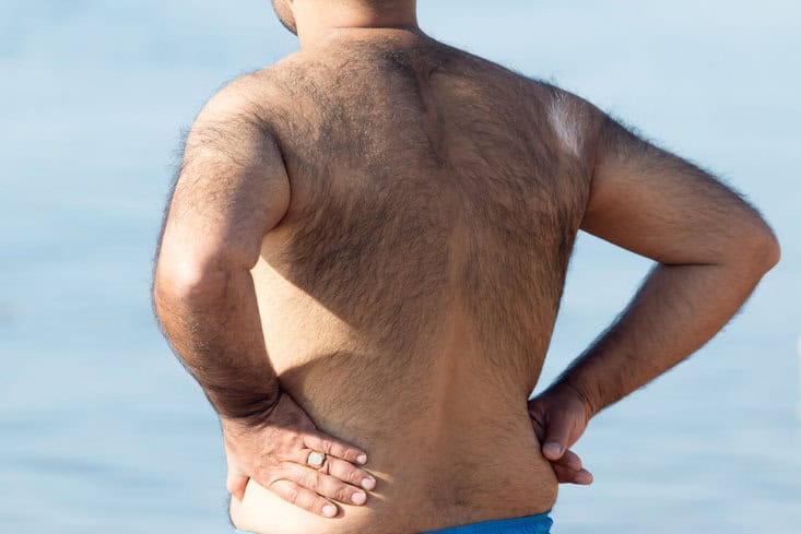 Male back hair eligible for laser hair removal