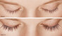 Latisse patient before and after results of eyelash growth length and thickness