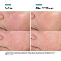 SkinCeuticals Advanced RGN-6 - Image 8